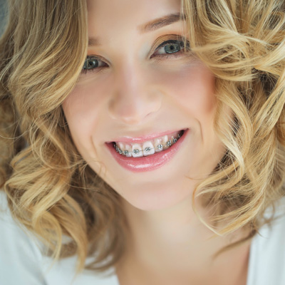 The Culver Marina Dental Group | Dental Bridges, Night Guards and Sports Mouthguards